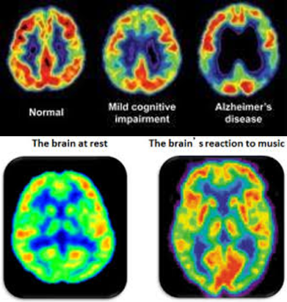 brain on music